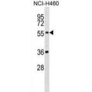 Xk-Related Protein 2 (XKRX) Antibody