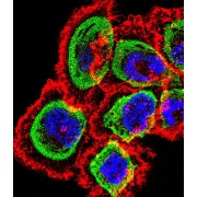 Calcipressin-1 (RCAN1) Antibody