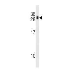 Calcipressin-1 (RCAN1) Antibody