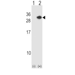 Calcipressin-1 (RCAN1) Antibody