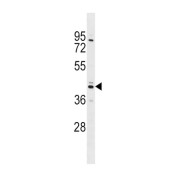 Sex Hormone-Binding Globulin (SHBG) Antibody