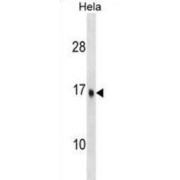 Ubiquitin-Conjugating Enzyme E2 D3 (UBE2D3) Antibody