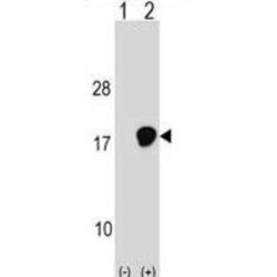 Ubiquitin-Conjugating Enzyme E2 D3 (UBE2D3) Antibody