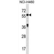 Islet Cell Autoantigen 1 (ICA1) Antibody