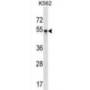 POU Class 3 Homeobox 2 (POU3F2) Antibody
