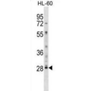 Lymphocyte Antigen 6 Complex Locus Protein G6f (LY6G6F) Antibody