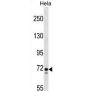 Polypeptide N-Acetylgalactosaminyltransferase 6 (GALNT6) Antibody