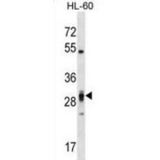 Pleckstrin Homology Domain-Containing Family F Member 2 (PLEKHF2) Antibody