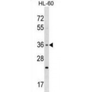 Taste 2 Receptor Member 7 (TAS2R7) Antibody