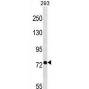 Phosphate-Regulating Neutral Endopeptidase (PHEX) Antibody