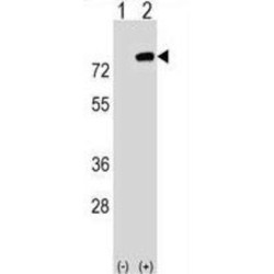 PBX Homeobox Interacting Protein 1 (PBXIP1) Antibody