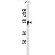 Beta-1,3-Galactosyl-O-Glycosyl-Glycoprotein Beta-1,6-N-Acetylglucosaminyltransferase 3 (GCNT3) Antibody