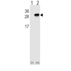 Interleukin 28B (IL28B) Antibody