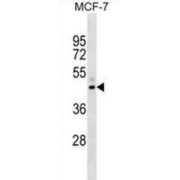 Nuclear Receptor Subfamily 2 Group F Member 6 (NR2F6) Antibody