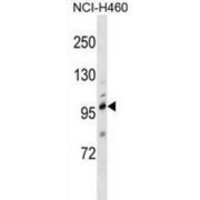 Transient Receptor Potential Cation Channel Subfamily C Member 1 (TRPC1) Antibody