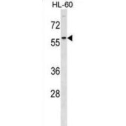 Doublecortin Domain-Containing Protein 2 (DCDC2) Antibody