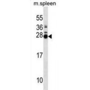 Mps One Binder Kinase Activator-Like 2B (MOL2B) Antibody