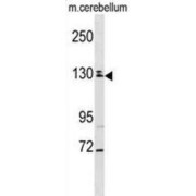 TBC1 Domain Family Member 8 (TBC1D8) Antibody