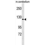 Semaphorin 6D (SEMA6D) Antibody