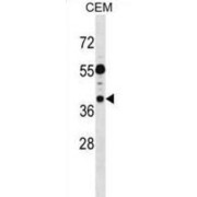 Tumor-Suppressing Subchromosomal Transferable Fragment Candidate Gene 1 Protein (TSSC1) Antibody