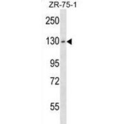 Hexokinase Domain Containing 1 (HKDC1) Antibody