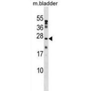 Protein Tyrosine Phosphatase Type IVA 1 (PTP4A1) Antibody