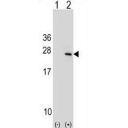 Protein Tyrosine Phosphatase Type IVA 1 (PTP4A1) Antibody