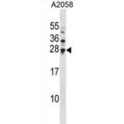 Ubiquitin-Conjugating Enzyme E2 H (UBE2H) Antibody