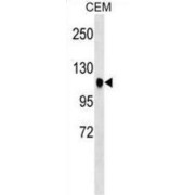 Ataxin 7 (ATXN7) Antibody