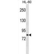 MutS Protein Homolog 5 (MSH5) Antibody