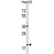 WB analysis of extracts of HepG2 cell line lysates (35 µg/lane), using PPM1M Antibody.