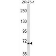 SH3 Domain Binding Protein 1 (SH3BP1) Antibody