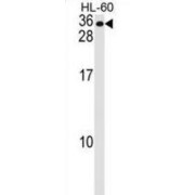 WB analysis of HL-60 cell line lysates (35 µg/lane), using MS4A7 antibody.
