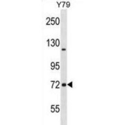 Neurochondrin (NCDN) Antibody