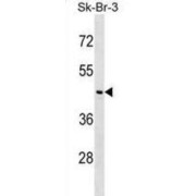 Neuronal Growth Regulator 1 (NEGR1) Antibody