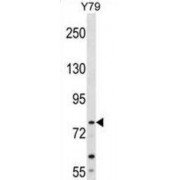 Mitochondrial Translational Initiation Factor 2 (MTIF2) Antibody