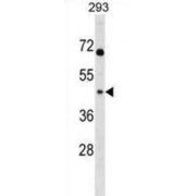 Mitochondrial Ribosomal Protein L39 (MRPL39) Antibody