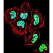 Zinc Finger Protein 155 (ZNF155) Antibody