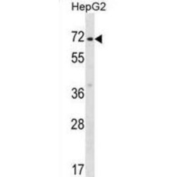 Zinc Finger Protein 155 (ZNF155) Antibody