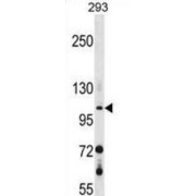 Retinal Guanylyl Cyclase 2 (GUCY2F) Antibody