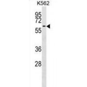 Coagulation Factor IX (F9) Antibody
