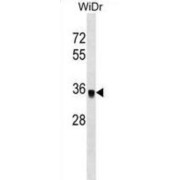 Protein Phosphatase 1 Catalytic Subunit Gamma (PPP1CC) Antibody