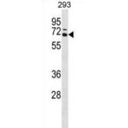 Coactivator-Associated Arginine Methyltransferase 1 (CARM1) Antibody