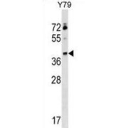 WB analysis of Y79 cell line lysates.