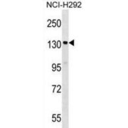 Signal-Induced Proliferation-Associated Protein 1 (SIPA1) Antibody