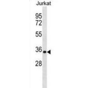 Heterogeneous Nuclear Ribonucleoprotein A1 (HNRNPA1) Antibody