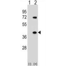 Heterogeneous Nuclear Ribonucleoprotein A1 (HNRNPA1) Antibody