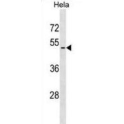 Vasoactive Intestinal Polypeptide Receptor 2 (VIPR2) Antibody