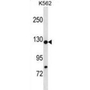 Histone Cell Cycle Regulator (HIRA) Antibody