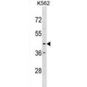 Chemokine C-X3-C-Motif Motif Receptor 1 (CX3CR1) Antibody